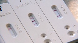 В Могилеве можно сделать платный тест на антитела к COVID-19