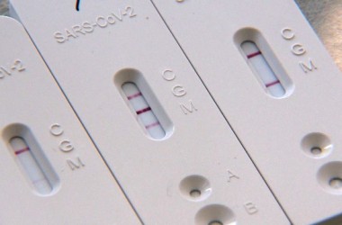 В Могилеве можно сделать платный тест на антитела к COVID-19