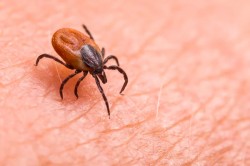 За 9 месяцев в Могилевской области зарегистрировано около 4 тысяч обращений после укусов клещей