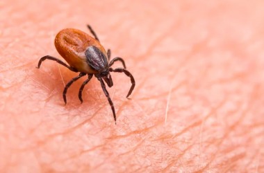 За 9 месяцев в Могилевской области зарегистрировано около 4 тысяч обращений после укусов клещей