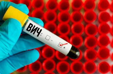 40 случаев ВИЧ-инфекции выявлено за 1 квартал в Могилевской области