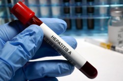 Активизация вирусного гепатита А отмечается в Беларуси