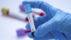 Резкого подъема заболеваемости COVID-19 пока нет в Беларуси