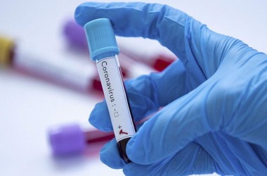 Резкого подъема заболеваемости COVID-19 пока нет в Беларуси