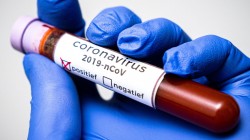 В Беларуси приостановлено оказание плановой медпомощи из-за коронавируса