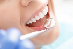 Минздрав опубликовал новые тарифы на стоматологические услуги