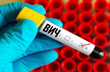 За 2 месяца 2024 года 23 случая ВИЧ-инфекции зарегистрировано в Могилевской области